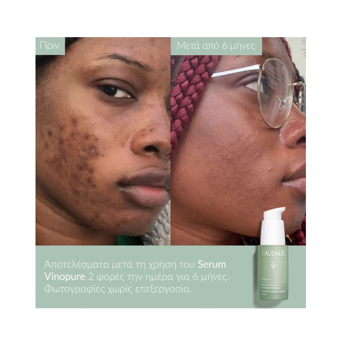 Caudalie Vinopure Blemish Control Salicylic Acid Serum