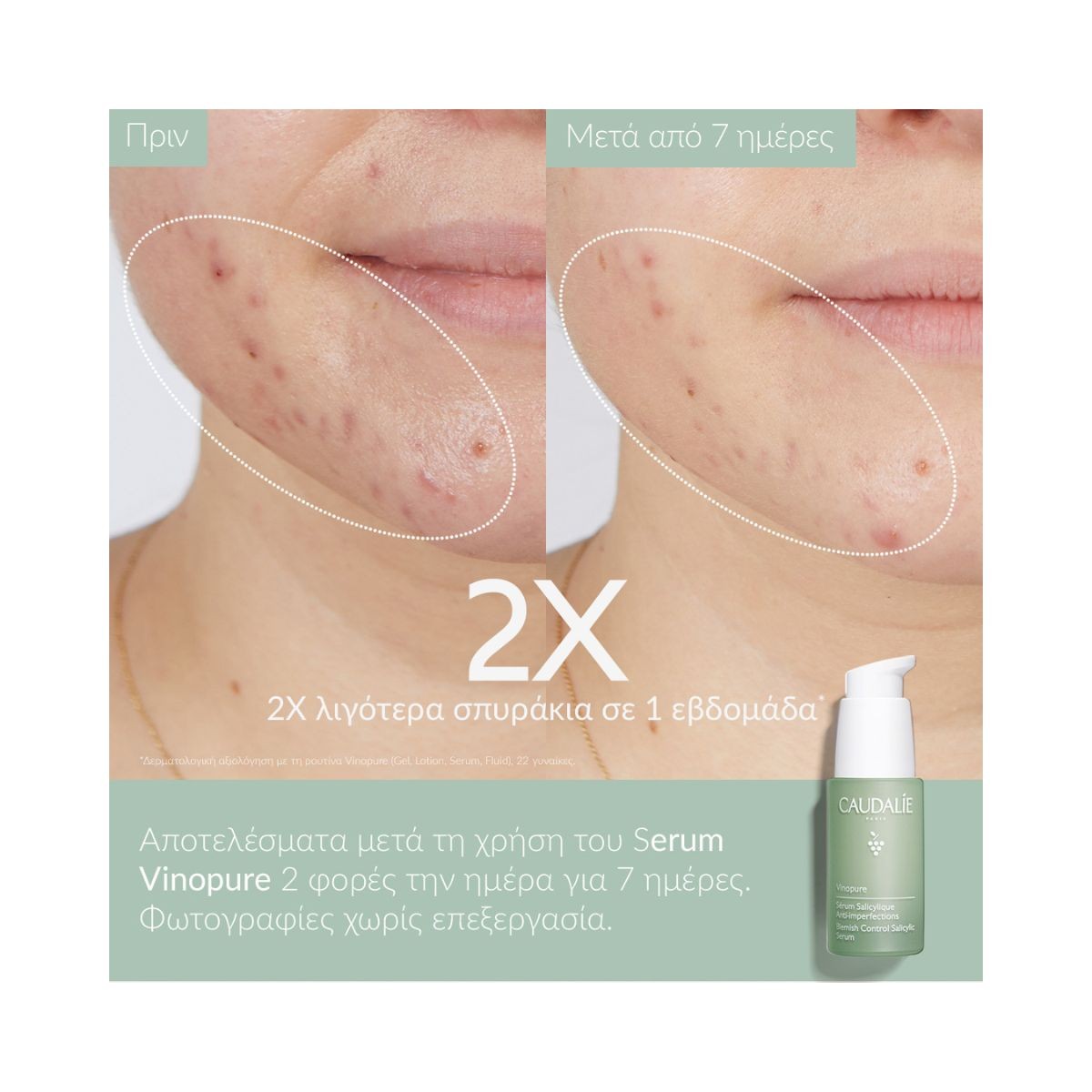 Caudalie Vinopure Blemish Control Salicylic Acid Serum