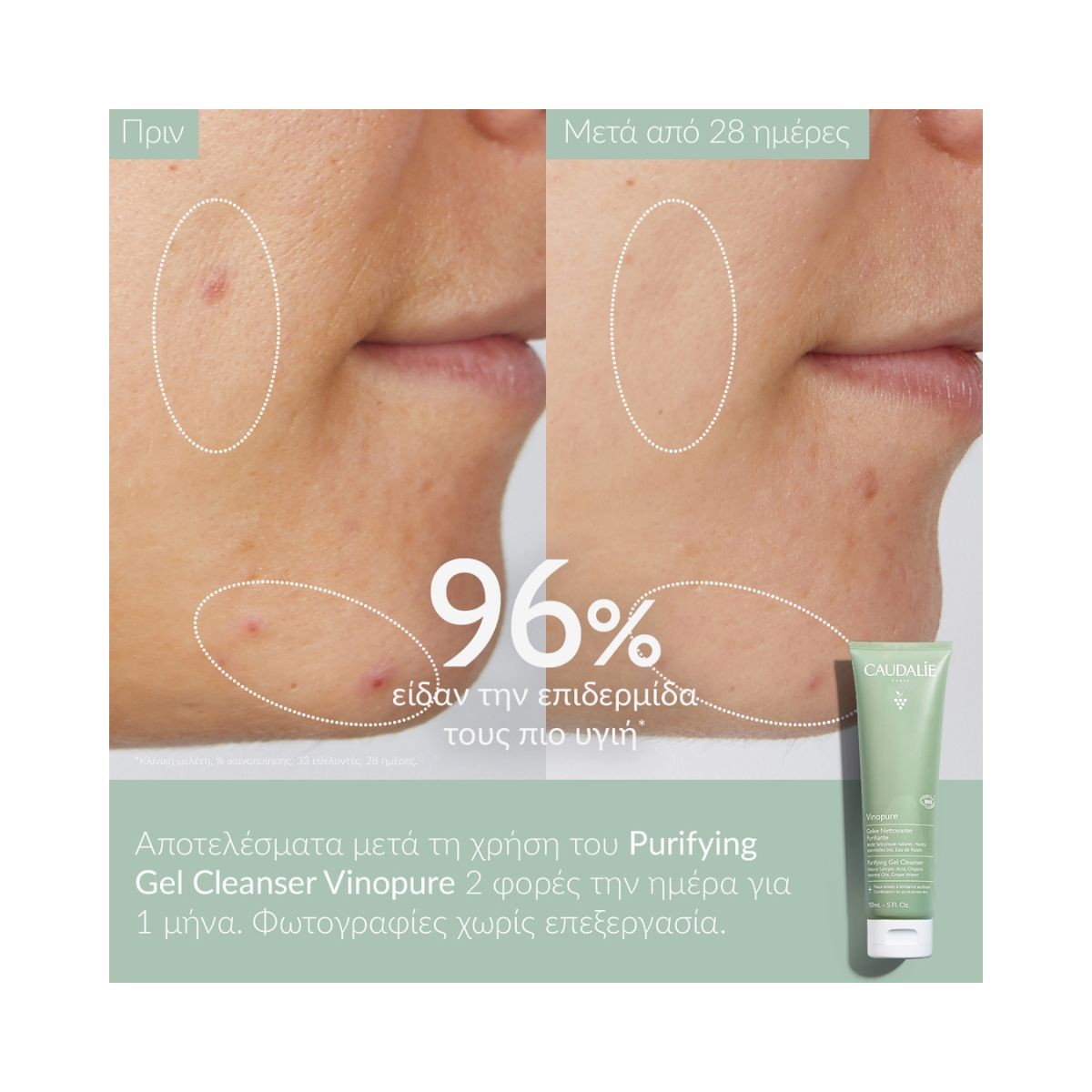 Caudalie Vinopure Purifying Gel Cleanser 150ml