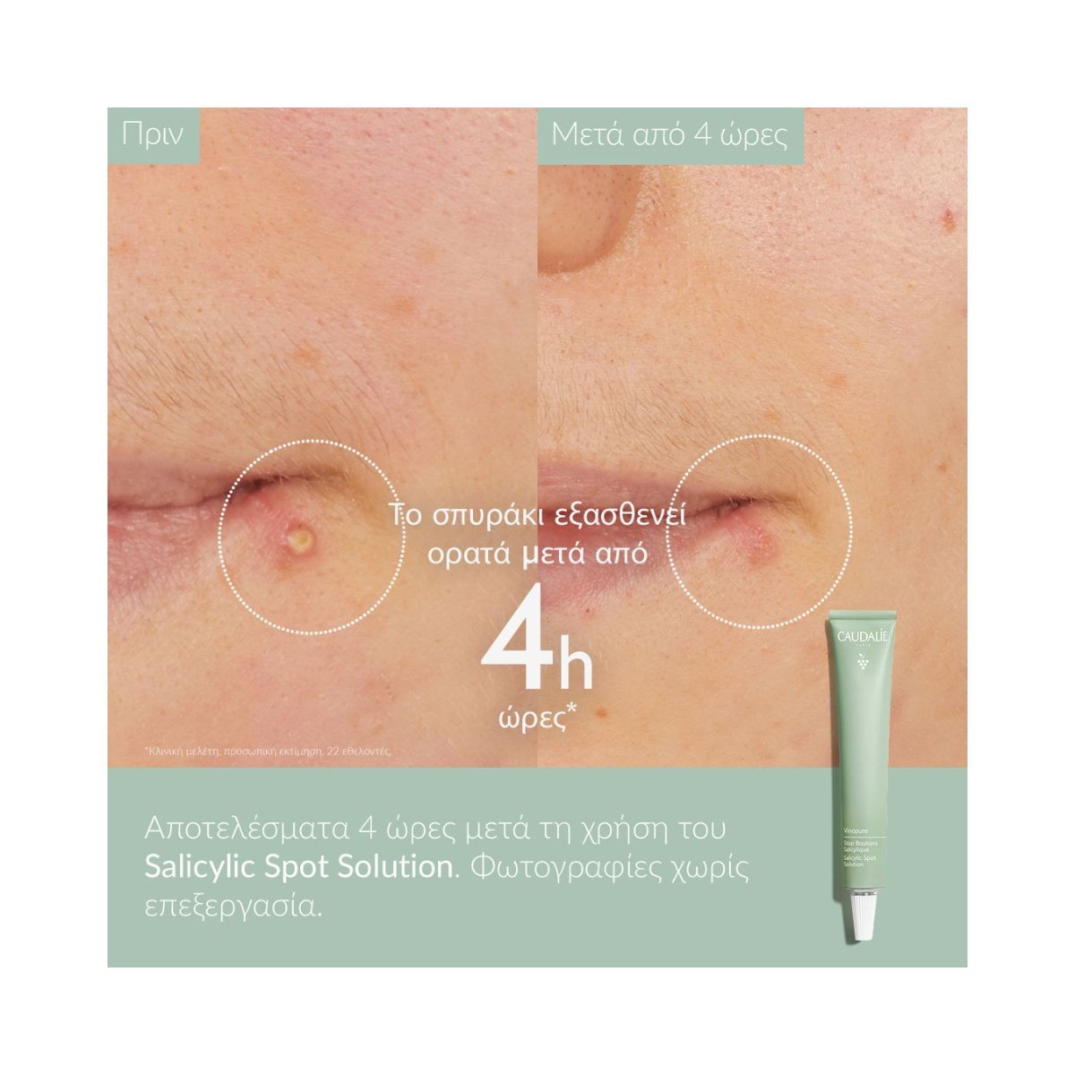 Caudalie Vinopure Salicylic Spot Solution 15ml